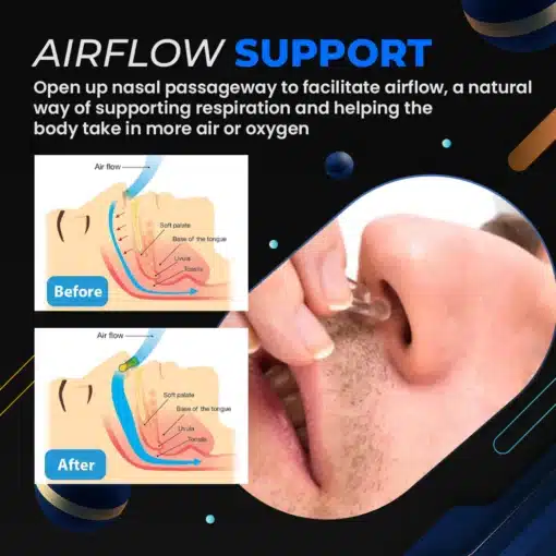 NoSnore™ Anti Snoring Device 2.webp