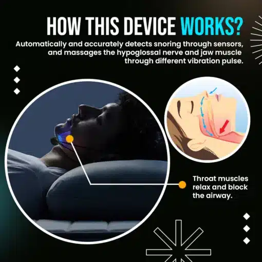 SleepRex™ Smart Anti Snoring Device 2.webp