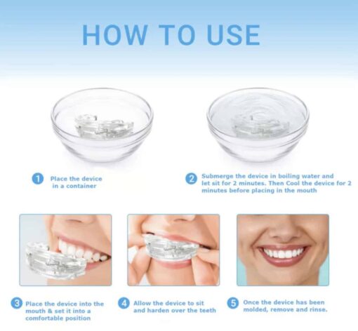 SleepGuardian Anti-Snoring Mouthpiece