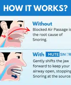 MuteSnore™ Mouthpiece 2