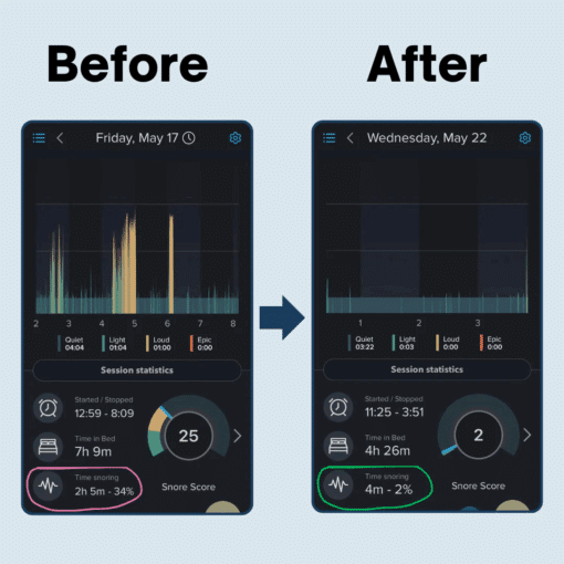 SnoreGrip Pro 4