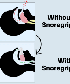 SnoreGrip Pro 5