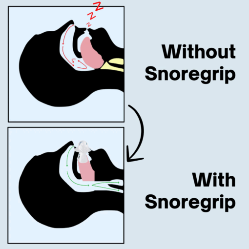 SnoreGrip Pro 5