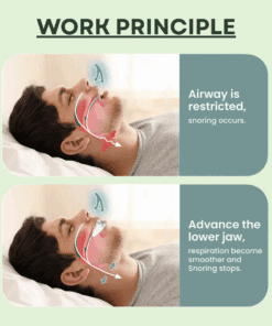 VELIX™ Anti Snoring Mouthpiece 5